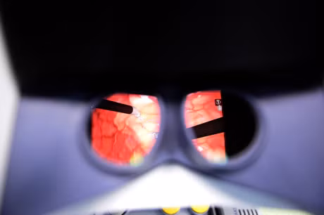 Robot phau thuat cho nguoi lon dau tien o Viet Nam - Anh 7