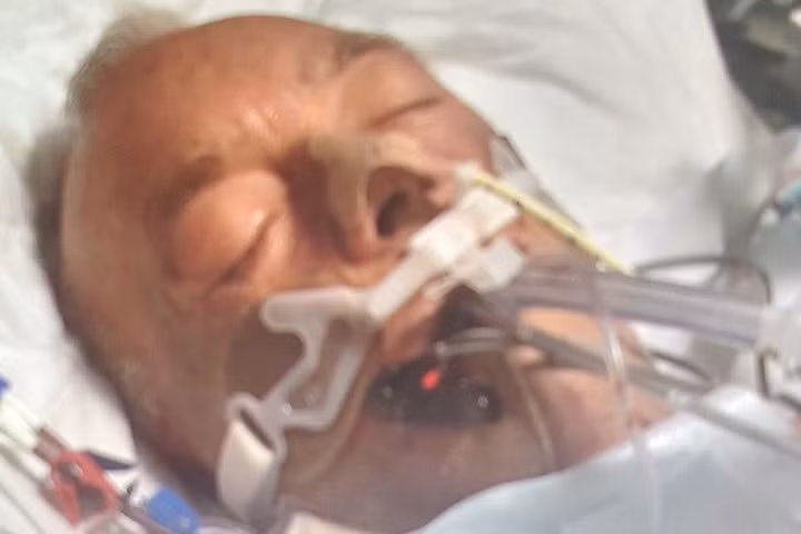 Mất chân, cắt thận sau khi bị chó liếm