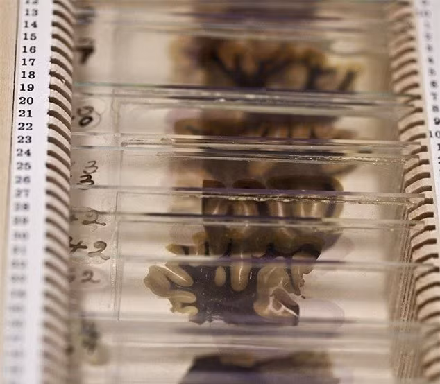 Cận cảnh một số tiêu bản kính hiển vi chứa các lát não của Eistein, đang được trưng bày tại Bảo tàng Mutter.