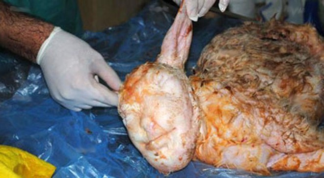 Một con cừu mẹ tại ngoại ô thành phố Izmir, Thổ Nhĩ Kỳ, đã đẻ một con cừu con có khuôn mặt người vào năm 2010. Bác sĩ thú y Erhan Elibol là người thực hiện ca mổ để lấy cừu con. Ông cho biết nó không hề có lông và chiếc đầu hoàn toàn giống đầu người với đôi tai là tai cừu. Tại thời điểm đó, bác sĩ Elibol khẳng định động vật dị dạng này là kết quả của một con cừu cái và một người đàn ông. Các nhà khoa học không kịp nghiên cứu để xác định nguyên nhân dị tật do người dân địa phương đã thiêu nó. Ảnh: List25. 25 con vật đột biến có hình thù kỳ quái (kỳ 1)