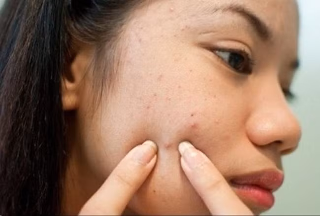 Da xấu chủ yếu là do gan có vấn đề.