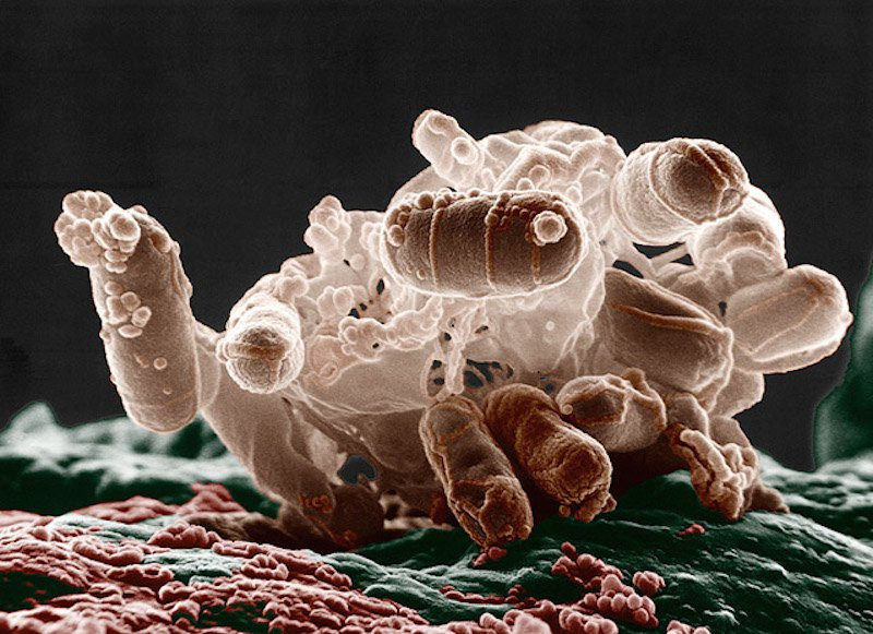 Tinhte-e-coli. Tinhte-e-coli.