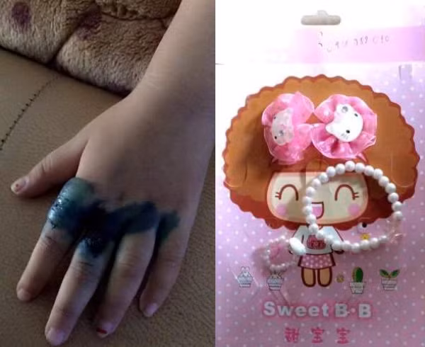 Cảnh báo nguy hiểm từ các loại đồ chơi nhẫn vòng Trung Quốc