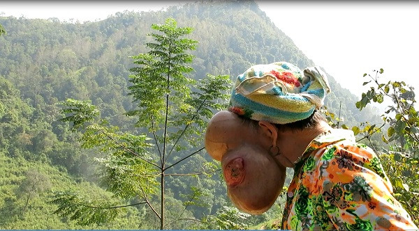 Cần nghiên cứu về thảm họa sơn nữ xinh đẹp bỗng mang “gương mặt quỷ”! ảnh 1