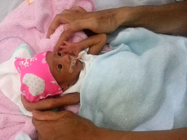 Hành trình chăm sóc con sinh non đầy gian nan của ông bố tự đỡ đẻ cho vợ