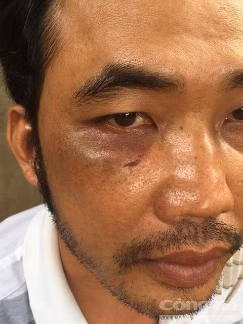 Phóng hỏa thiêu sống thương lái sầu riêng để giành lãnh địa - ảnh 2