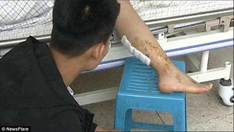 Hy hữu: Đang làm hôn lễ, váy cô dâu bốc cháy ngùn ngụt - Ảnh 5 Hy huu: Dang lam hon le, vay co dau boc chay ngun ngut - Anh 5