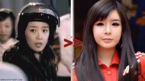 Thành viên đình đám Park Bom của nhóm nhạc nổi tiếng 2NE1 cũng nổi bật trong danh sách này. Khuôn mặt cô thay đổi theo thời gian và đó là điều không ai có thể phủ nhận. Nhiều fan của nữ ca sĩ hiện vẫn tin rằng sở dĩ mặt cô bị sưng là do căn bệnh viêm hạch bạch huyết. Bản thân Park Bom cũng chưa từng thừa nhận việc phẫu thuật thẩm mỹ.