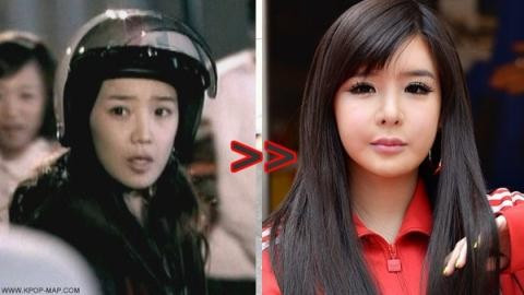 Thành viên đình đám Park Bom của nhóm nhạc nổi tiếng 2NE1 cũng nổi bật trong danh sách này. Khuôn mặt cô thay đổi theo thời gian và đó là điều không ai có thể phủ nhận. Nhiều fan của nữ ca sĩ hiện vẫn tin rằng sở dĩ mặt cô bị sưng là do căn bệnh viêm hạch bạch huyết. Bản thân Park Bom cũng chưa từng thừa nhận việc phẫu thuật thẩm mỹ. Thành viên đình đám Park Bom của nhóm nhạc nổi tiếng 2NE1 cũng nổi bật trong danh sách này. Khuôn mặt cô thay đổi theo thời gian và đó là điều không ai có thể phủ nhận. Nhiều fan của nữ ca sĩ hiện vẫn tin rằng sở dĩ mặt cô bị sưng là do căn bệnh viêm hạch bạch huyết. Bản thân Park Bom cũng chưa từng thừa nhận việc phẫu thuật thẩm mỹ.