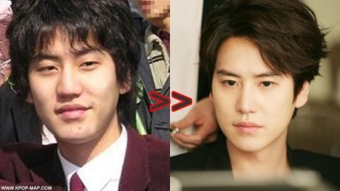 Trai đẹp Kyuhyun của Super Junior cũng từng thừa nhận việc phẫu thuật thẩm mỹ để có mắt hai mí vào tháng 12 năm ngoái để không thua bạn kém bè. Nhan sắc của sao Hàn khi chưa phẫu thuật thẩm mỹ
