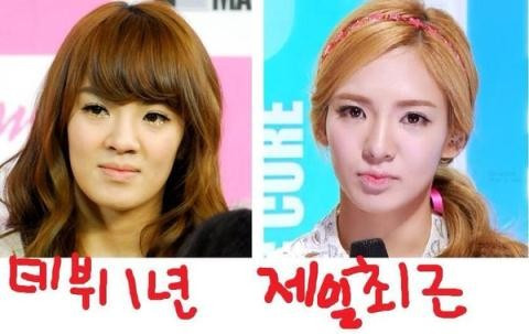Hai bên xương hàm của Hyoyeon (SNSD) so với trước đây đã trở nên thon gọn hơn. Nhan sắc của sao Hàn khi chưa phẫu thuật thẩm mỹ