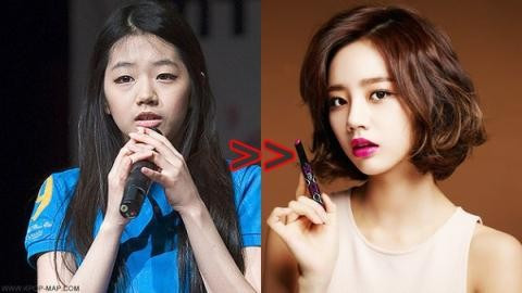 Nữ ca sĩ Hyeri của nhóm nhạc nữ Girl"s Day cũng đẹp lên thấy rõ khi quyết dùng dao kéo cho "cửa sổ tâm hồn". Hyeri được cho là phẫu thuật thẩm mỹ để có đôi mắt to tròn và đẹp hút hồn. Mũi của nữ ca sĩ cũng trông thanh thoát hơn so với trước kia. Nhan sắc của sao Hàn khi chưa phẫu thuật thẩm mỹ
