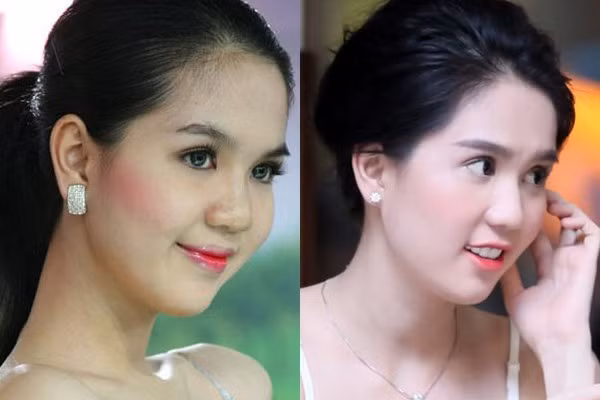 “Nghi vấn” Ngọc Trinh dao kéo hóa cằm Vline ảnh 1