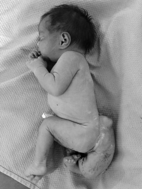 Khong sieu am thai, me 