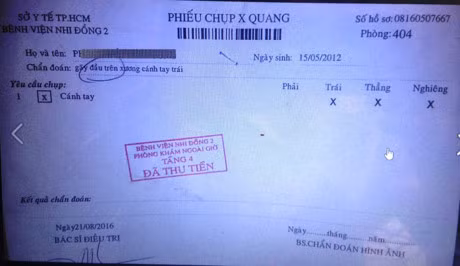 Bi hai, tre gay tay duoc bac si chua trat khop, bong gan - Anh 2