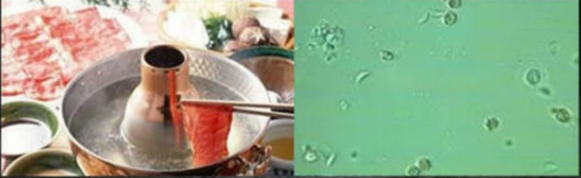 Những hiểm họa trong các món ăn tái - Ảnh 7 Những hiểm họa trong các món ăn tái - Ảnh 7