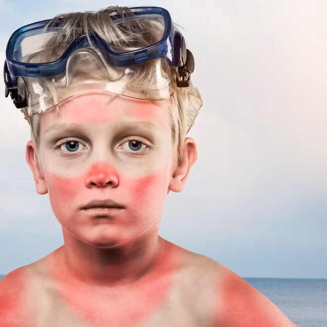 3. Thoa kem chống nắng: Tia UV là nguyên nhân hàng đầu khiến nếp nhăn, ung thư da nhanh xuất hiện. Trong những ngày chỉ số tia UV tăng cao, phơi nắng lâu dài sẽ làm da bị phồng rộp, cháy nắng. Các thương tổn tích lũy dần theo thời gian. Khi chúng trở nên nghiêm trọng sẽ rất khó khắc phục. Sử dụng kem chống nắng vào ban ngày để bảo vệ da tốt hơn. Ngoài ra, tia UV cũng có thể đi xuyên qua cửa sổ. Nếu bạn ngồi gần cửa sổ ở nhà hoặc văn phòng, đừng quên thoa kem chống nắng. Ảnh: The Irish Times.