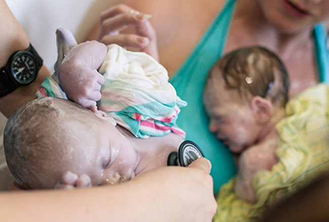 “Xem tận mắt” cặp song sinh chui ra từ bụng mẹ ảnh 9