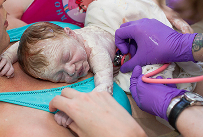 “Xem tận mắt” cặp song sinh chui ra từ bụng mẹ ảnh 6