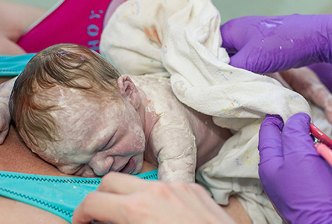 “Xem tận mắt” cặp song sinh chui ra từ bụng mẹ ảnh 5