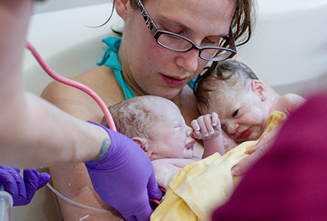 “Xem tận mắt” cặp song sinh chui ra từ bụng mẹ ảnh 12