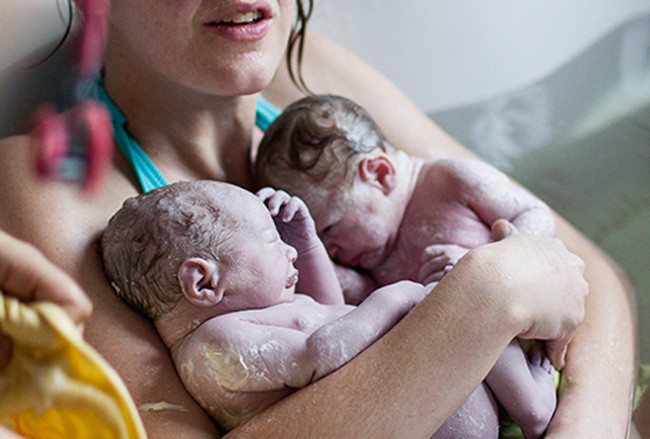 “Xem tận mắt” cặp song sinh chui ra từ bụng mẹ ảnh 11