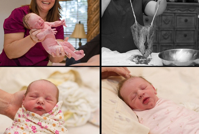 “Xem tận mắt” cặp song sinh chui ra từ bụng mẹ ảnh 15