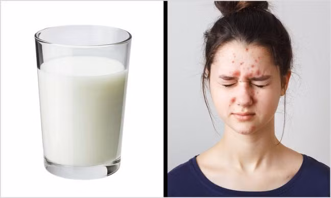 Nhung thuc pham gay lao hoa, nep nhan, mun trung ca ban nen tranh