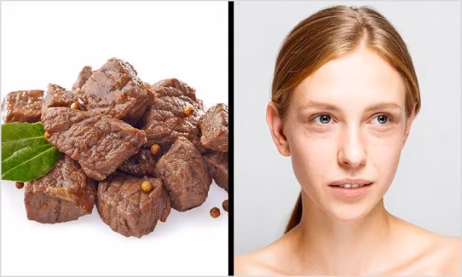 Nhung thuc pham gay lao hoa, nep nhan, mun trung ca ban nen tranh