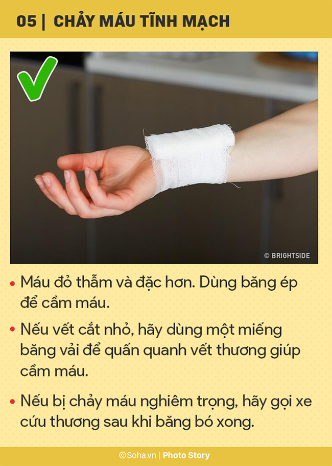 8 lời khuyên có thể cứu mạng sống của bạn và người thân trong tình huống nguy hiểm ảnh 5 8 lời khuyên có thể cứu mạng sống của bạn và người thân trong tình huống nguy hiểm ảnh 5