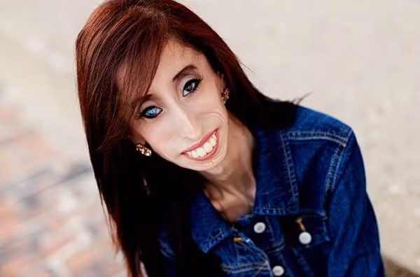 Những người phụ nữ kỳ lạ gây ngạc nhiên cho toàn thế giới ảnh 10