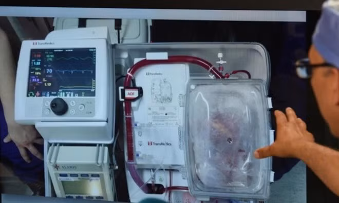 Nguồn: theguardian.com
