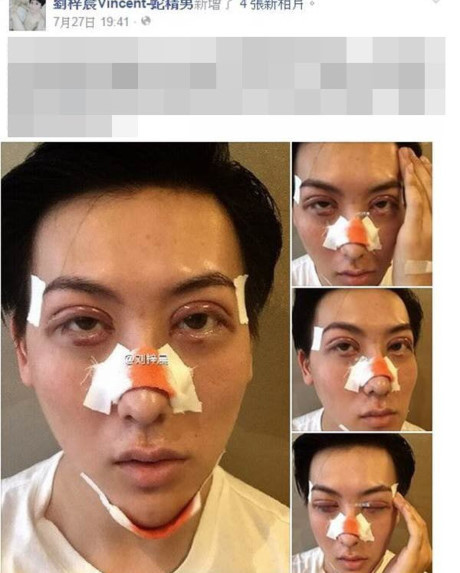 Thực hư chuyện hot boy mặt rắn tự tử vì phẫu thuật thẩm mỹ hỏng - Ảnh 3 Thuc hu chuyen hot boy mat ran tu tu vi phau thuat tham my hong - Anh 3