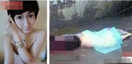 Thực hư chuyện hot boy mặt rắn tự tử vì phẫu thuật thẩm mỹ hỏng - Ảnh 2 Thuc hu chuyen hot boy mat ran tu tu vi phau thuat tham my hong - Anh 2