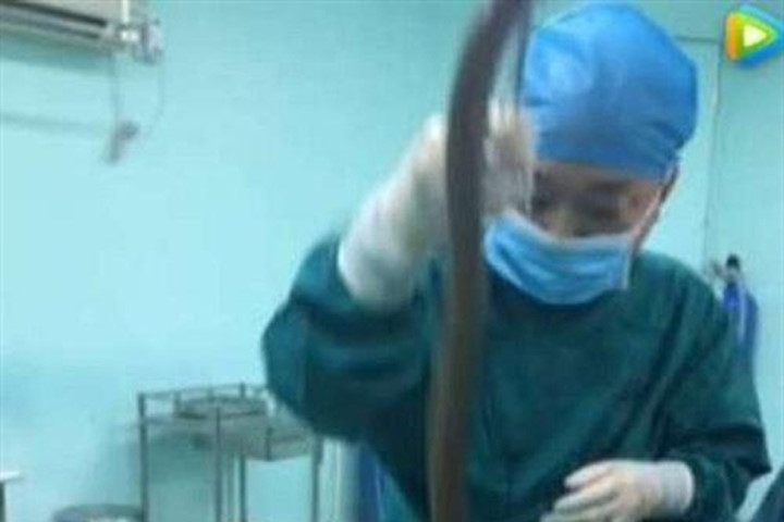 Không thể tin người đàn ông này nhét con lươn gần nửa mét vào người