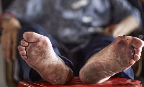 Cu ba bo chan khi len 5 tuoi, hinh anh doi chan sau 100 nam that tan nat coi long - Anh 10