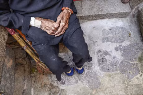 Cu ba bo chan khi len 5 tuoi, hinh anh doi chan sau 100 nam that tan nat coi long - Anh 9