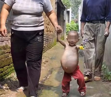 Chuyen bi an ve be gai 5 tuoi mang thai 