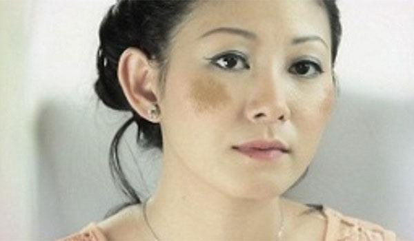 Mac benh nguy hiem vi KHONG an thit mo