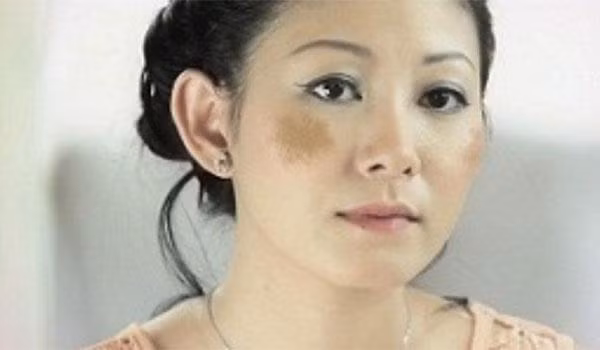 Mac benh nguy hiem vi KHONG an thit mo