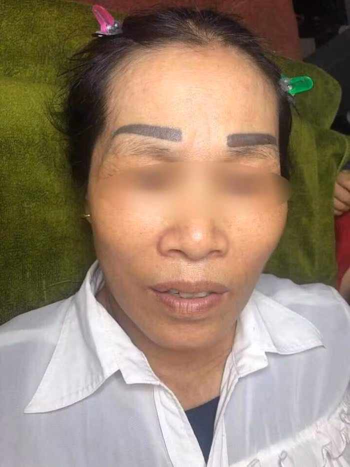 Chắc lúc soi gương nhìn thấy đôi lông mày bị xăm lệch này thì người phụ nữ sẽ khóc ròng mất thôi.