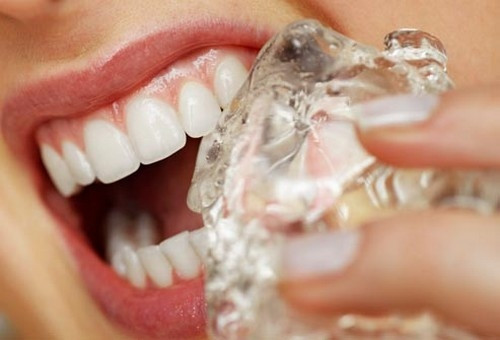 Mẹo nhỏ chữa đau nhức răng hiệu quả nhất