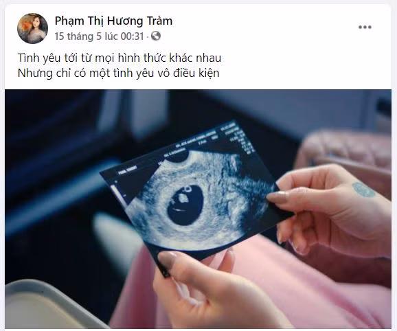Hương Tràm bất ngờ chia sẻ hình ảnh siêu âm thai nhi vào đúng ngày sinh nhật của mình.
