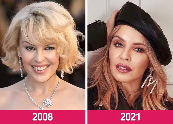 Kylie Minogue, 52 tuổi