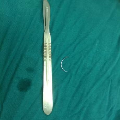 Kinh hai bac si bo quen gac, dien thoai, keo... trong bung benh nhan nhieu thang troi - Anh 2