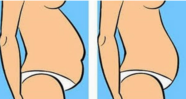 giảm mỡ bụng giảm mỡ bụng