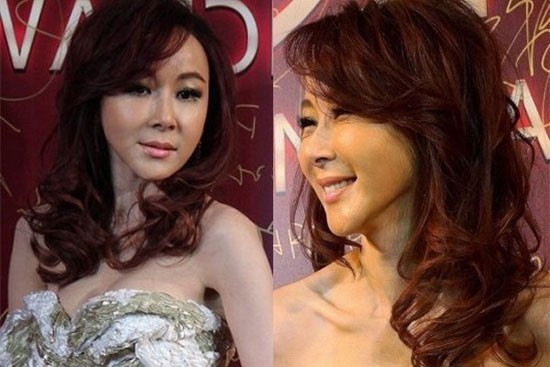 7 sao nữ châu Á có gương mặt cứng đơ vì thẩm mỹ 