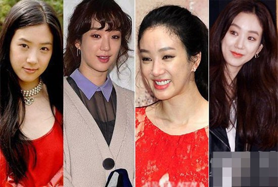 7 sao nữ châu Á có gương mặt cứng đơ vì thẩm mỹ 