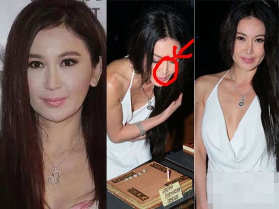 7 sao nữ châu Á có gương mặt cứng đơ vì thẩm mỹ 