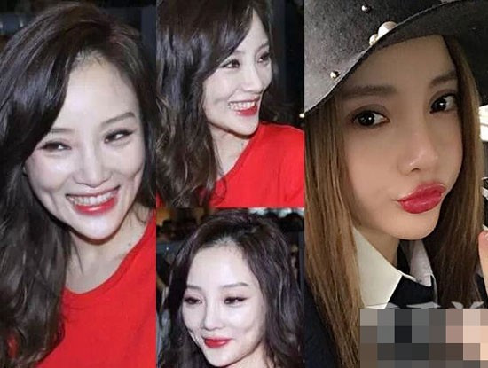 7 sao nữ châu Á có gương mặt cứng đơ vì thẩm mỹ 